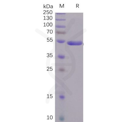 sp-pme100496 s1 protein ctd sp1