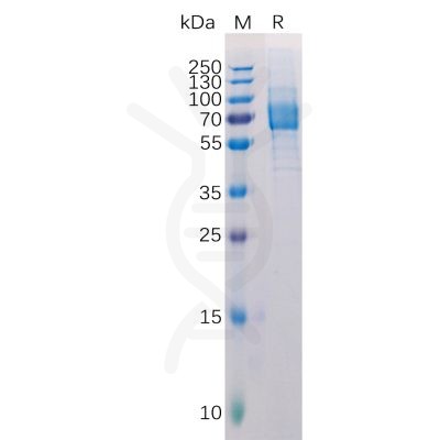 sp-pme100515 galectin 9 sp1