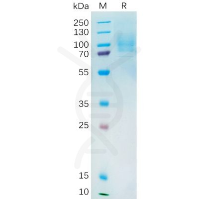 sp-pme100544 yap1 sp1