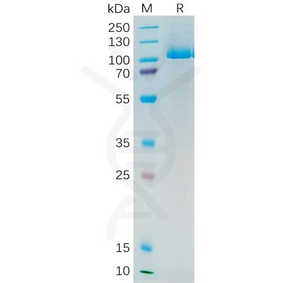 sp-pme100545 psma sp1