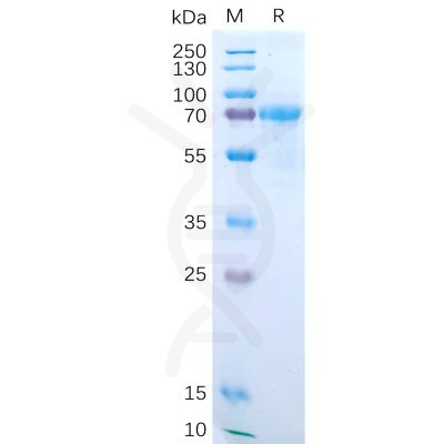 sp-pme100548 il15ra sp1