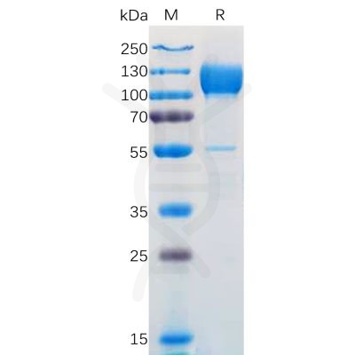 sp-pme100566 ntrk3 sp1