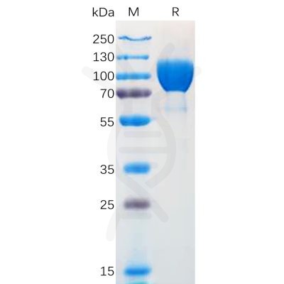 sp-pme100571 ntrk1 sp1