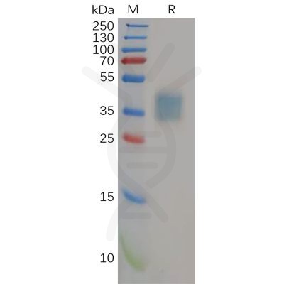 sp-pme100587 il21r sp1