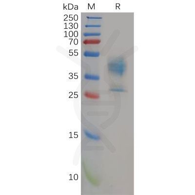 sp-pme100589 mdr 1 sp1