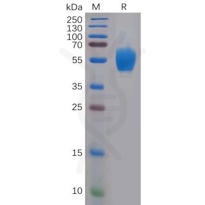 sp-pme100592 fgfr4 sp1