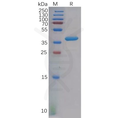 sp-pme100611 cxcl4 sp1