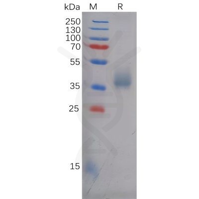 sp-pme100616 antxr1 sp1