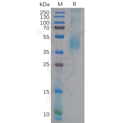 sp-pme100621 gfral sp1