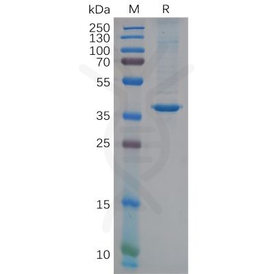 sp-pme100623 chi3l1 sp1