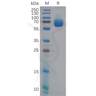 sp-pme100624 epha4 sp1