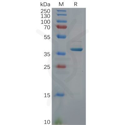 sp-pme100628 gdf15 sp1