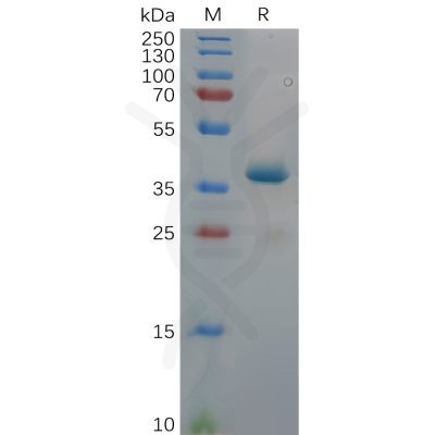 sp-pme100630 ror1 sp1