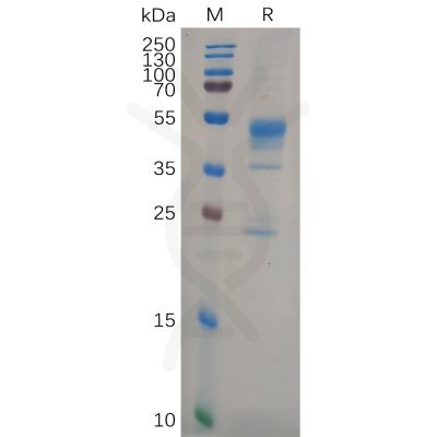 sp-pme100634 mmp9 sp1