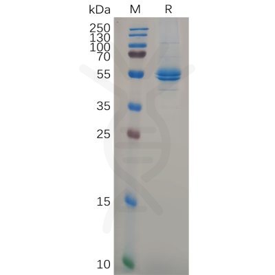 sp-pme100639 il11 sp1