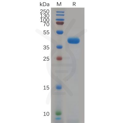 sp-pme100664 kcnk9 sp1