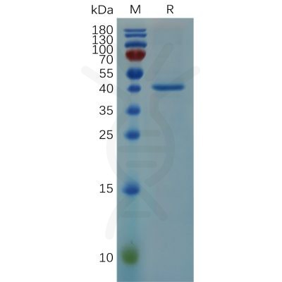 sp-pme100679 rnase4 sp1