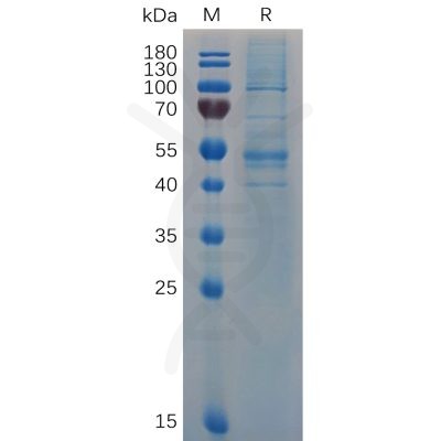 sp-pme100682 ifnb1 sp1