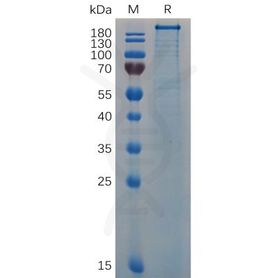 sp-pme100684 vwf sp1