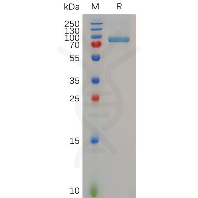 sp-pme100699 mmp13 sp1