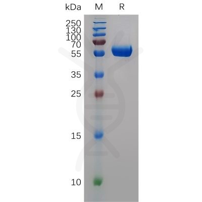 sp-pme100711 mmp9 sp1