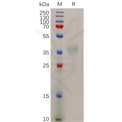 sp-pme100720 npc1l1 sp1