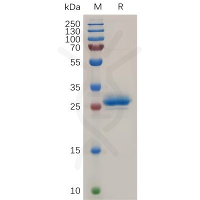 sp-pme100724 mesothelin sp1