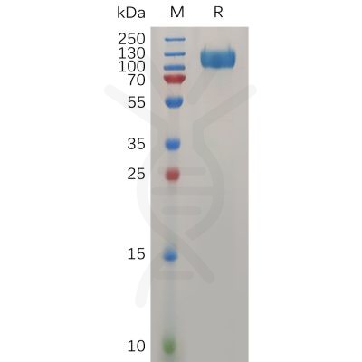 sp-pme100737 ifnar1 sp1