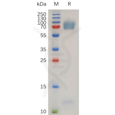 sp-pme100741 adgre2 sp1