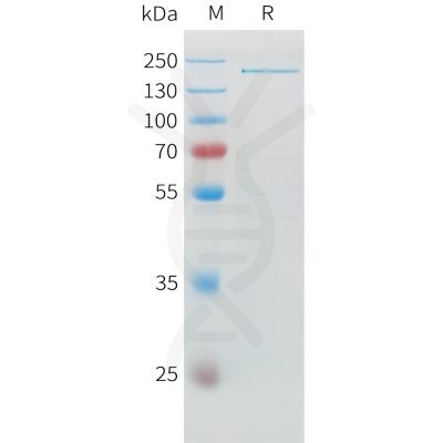 sp-pme100742 adamts13 sp1