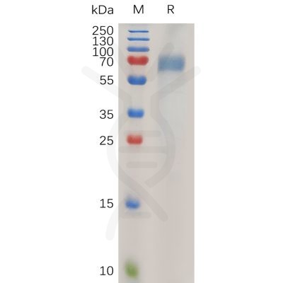 sp-pme100745 lilrb2 sp1