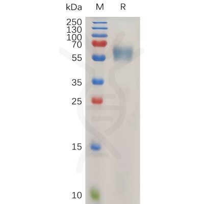 sp-pme100746 il1rap sp1