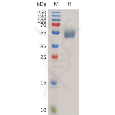 sp-pme100748 il1r2 sp1