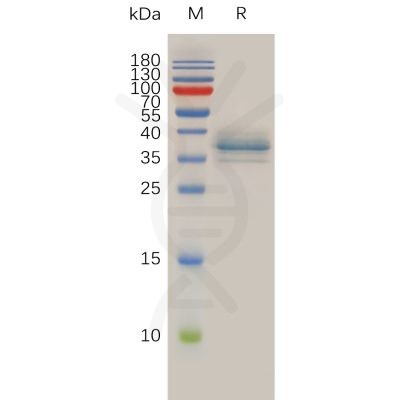 sp-pme100760 anxa1 sp1