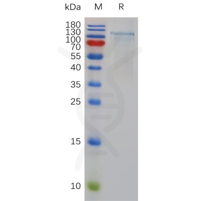 sp-pme100771 adamts1 sp1