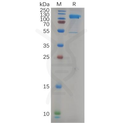 sp-pme100801 cdh17 sp1