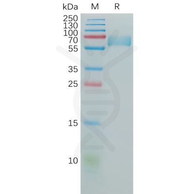 sp-pme100812 cd147 sp1