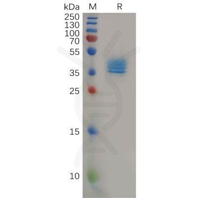 sp-pme100824 ccr4 sp1