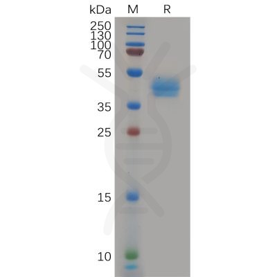 sp-pme100825 ccr7 sp1