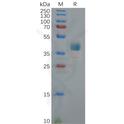 sp-pme100833 cxcr3 sp1