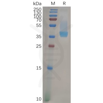 sp-pme100834 cxcr4 sp1