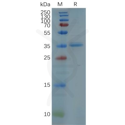 sp-pme100835 cxcr5 sp1