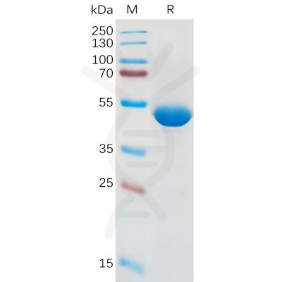 sp-pme100838 il1b sp1