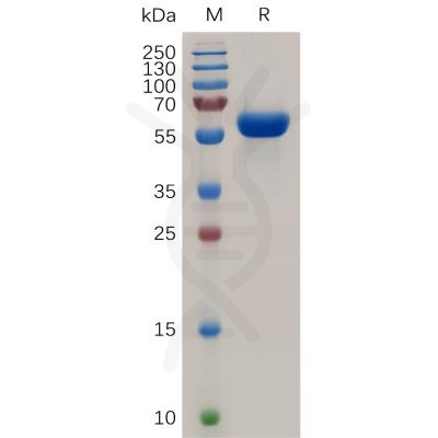 sp-pme100853 tnfrsf11a sp1