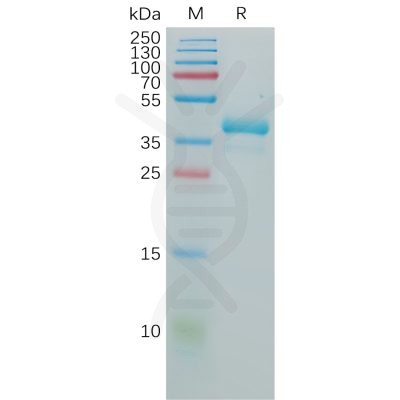 sp-pme100871 gnrhr sp1