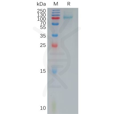 sp-pme100881 il12rb1 sp1