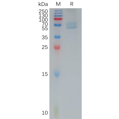 sp-pme101185 trpv1 sp1