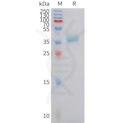 sp-pme101427 cxcr6 sp1