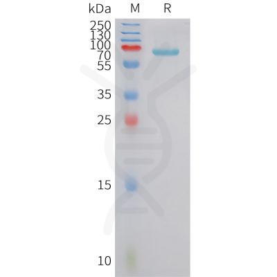 sp-pme101429 fstl3 sp1