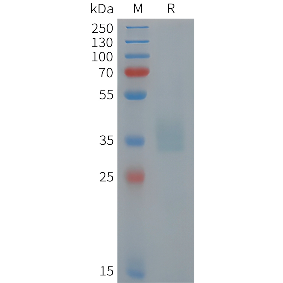 pme101449-pomc-sp1.jpg